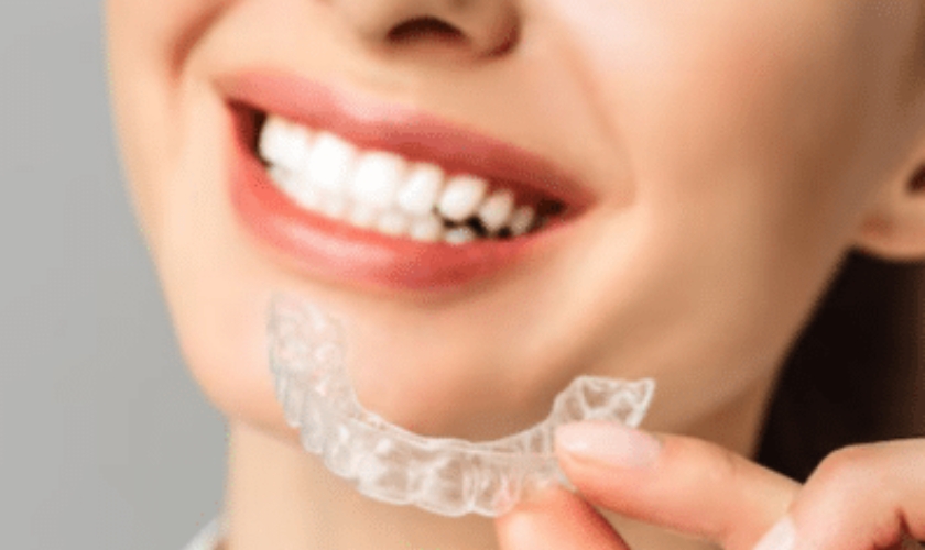 aftercare tips for invisalign treatment