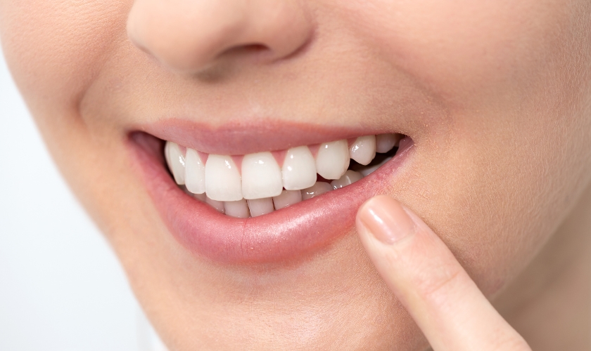 The Ideal Candidate For Teeth Whitening: Are You A Good Fit?