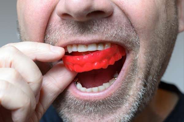 Save Your Teeth by Wearing Mouth Guards at Night from Regency Court Dentistry in Boca Raton, FL